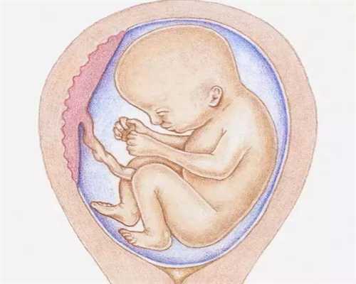 美国代孕生殖：月经不调会导致不孕吗？月经不