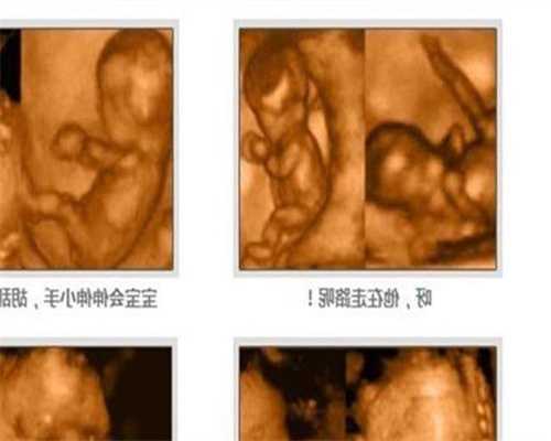 美国地下试管婴儿联系方法：诱发卵巢性不孕的
