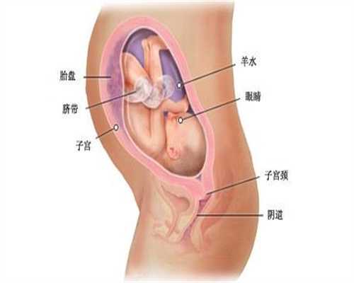 卵巢囊肿的原因主要有哪些