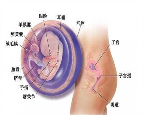 卵巢囊肿的原因主要有哪些