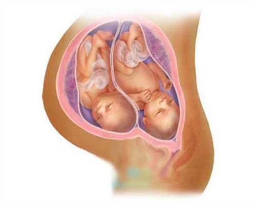代孕女孩包成功：多囊卵巢综合症怎么办呀