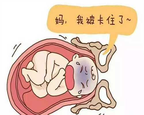 美国香港孕宝生殖中心：介绍盆腔积水有哪些明
