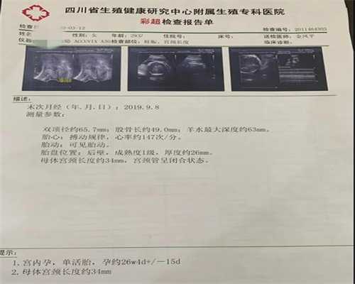 美国香港孕宝生殖中心：介绍盆腔积水有哪些明