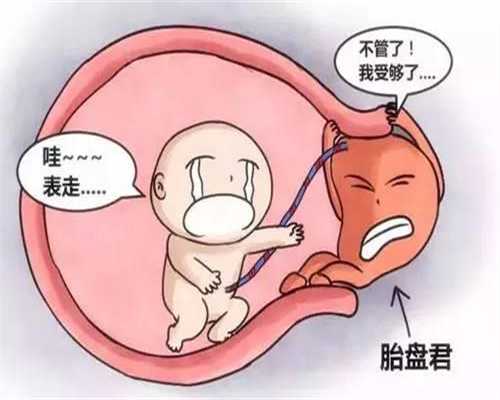 哪里可以找代孕：盆腔子宫粘连