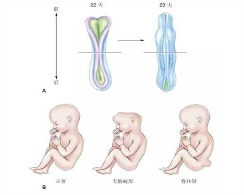 银川代孕中介，子宫畸形可能引起不孕