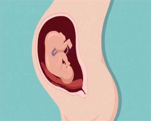 借卵怀孕对孕妇的影响，宫颈性不孕需要做什么