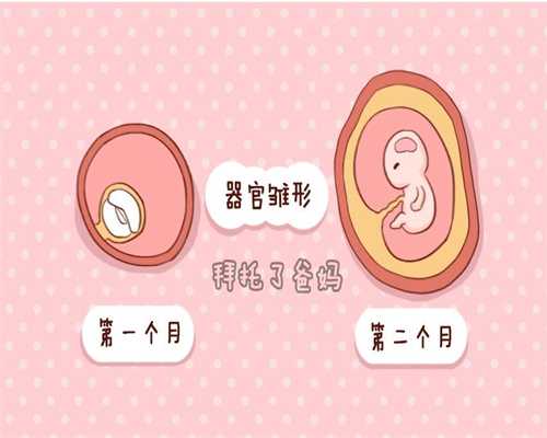 深圳代孕服务:检查多囊卵巢需要做哪项